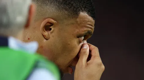 Mbappé se lesionou logo na estreia (Foto: Dean Mouhtaropoulos/Getty Images)