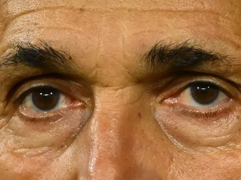 Fiorentina x Juventus: provável escalação sem a presença de Vlahovic