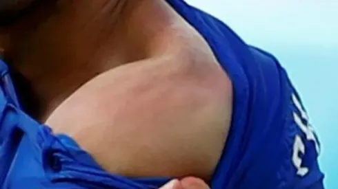 Photo reveals Luis Suarez bite marks On Italy's Giorgio Chiellini