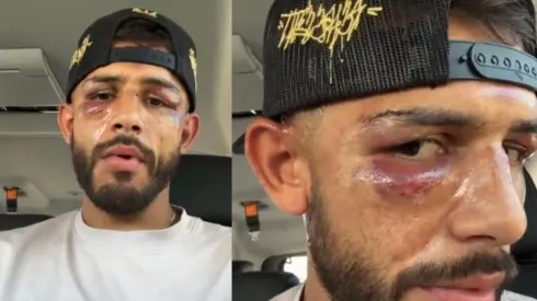 Yair Rodríguez se pronuncia tras derrota en UFC 290
IG @panteraufc