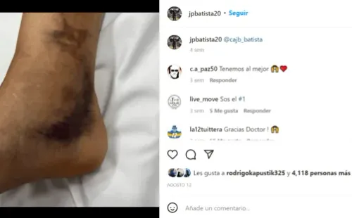 Así estaba Zeballos en sus primeros días de recuperación.