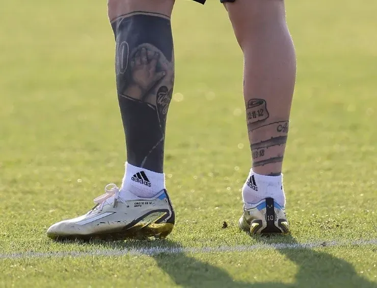 Así está el tobillo de Messi (foto: Getty)