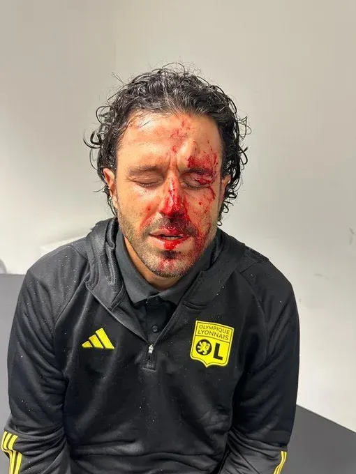 Grosso, herido por el ataque. (Foto: @Lequipe)