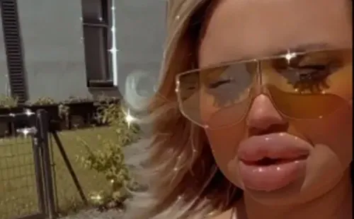 Modelo apareceu com lábios inchados. Foto: Reprodução/Instagram oficial Jessy Bunny