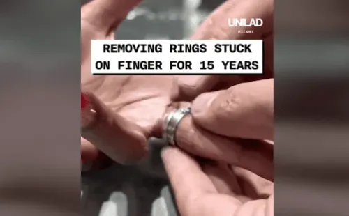 Anel ficou preso por 15 anos - Foto: UNILAD