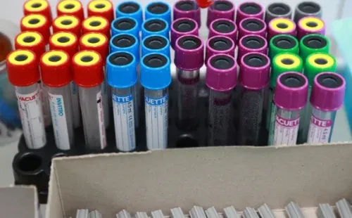 Pruebas de Coronavirus