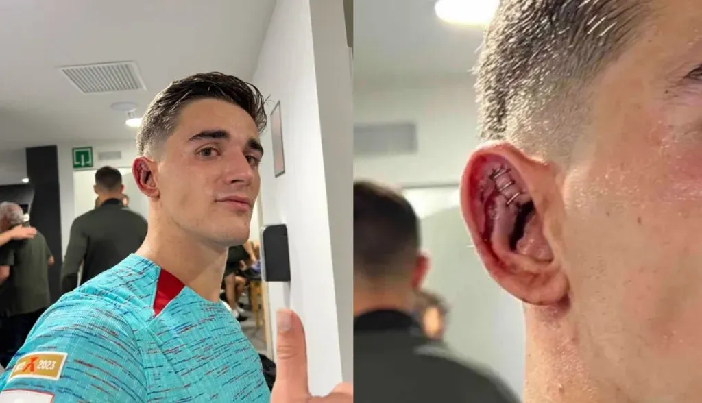 Oreja de Gavi tras Osasuna vs. Barcelona: TW