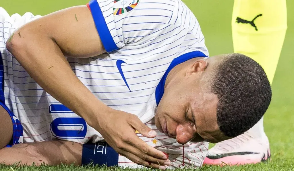 La dura lesión de Mbappé ante Austria: IMAGO