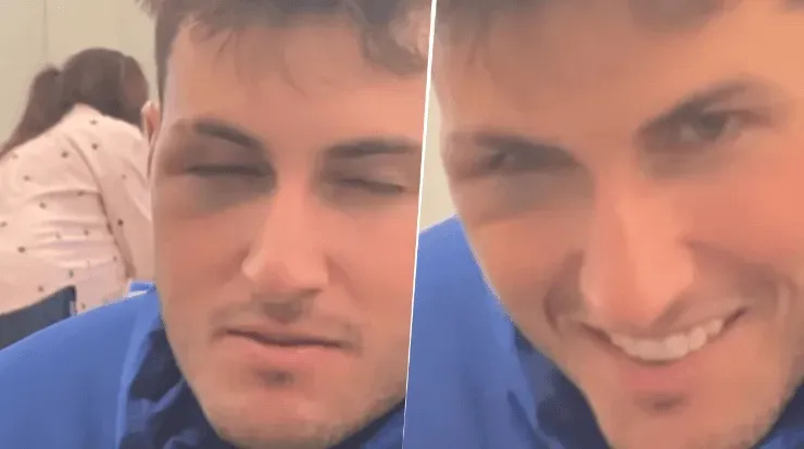 Santiago Giménez y su rostro desfigurado