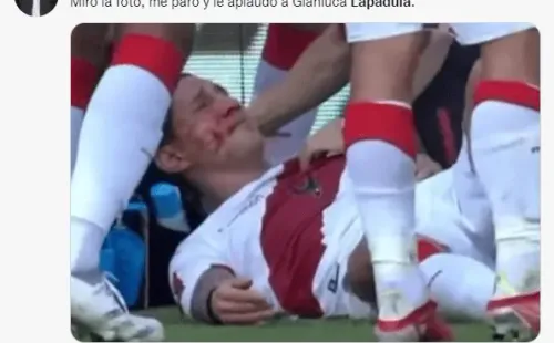 Así terminó Lapadula el partido contra Colombia.