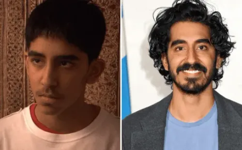 Dev Patel
