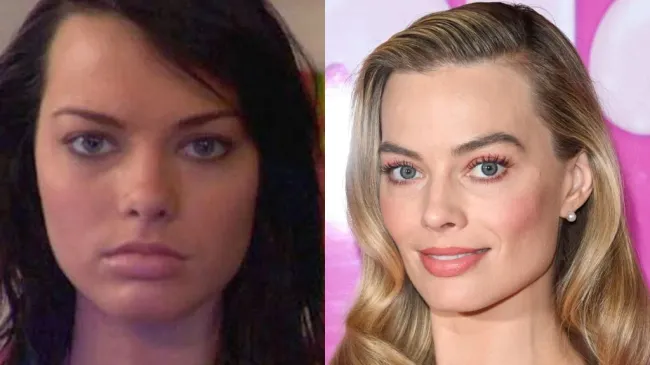 Margot Robbie antes de sus operaciones y en la actualidad. (Instagram/Getty Images)