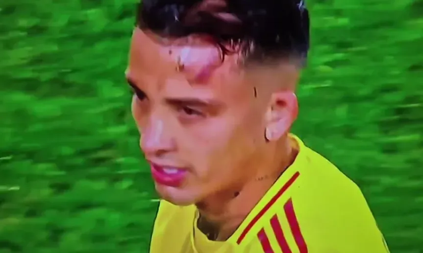 Herida de Kevin Castaño (X)