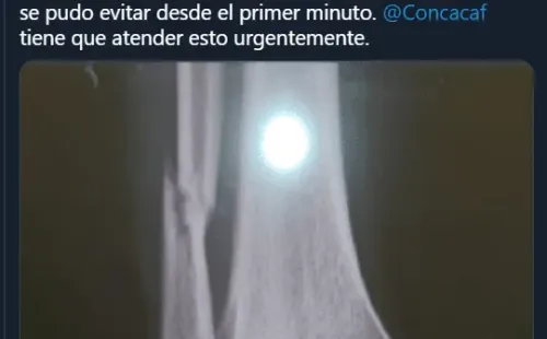 Periodistas se unenpor la recuperación del Chucho López / Twitter Fernando Palomo