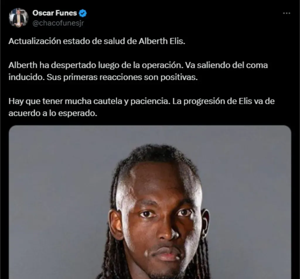 Alberth Elis va saliendo del coma inducido. (Foto: X)