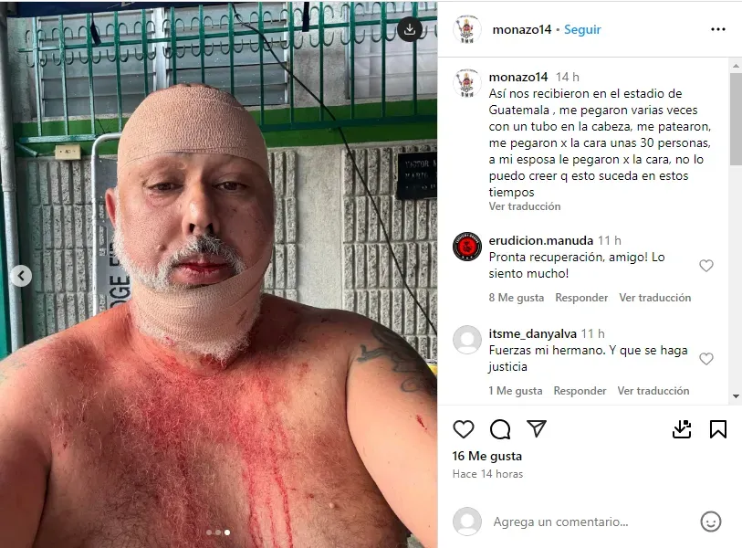 El propio Mono Castro contó lo sucedido en su cuenta de Instagram.