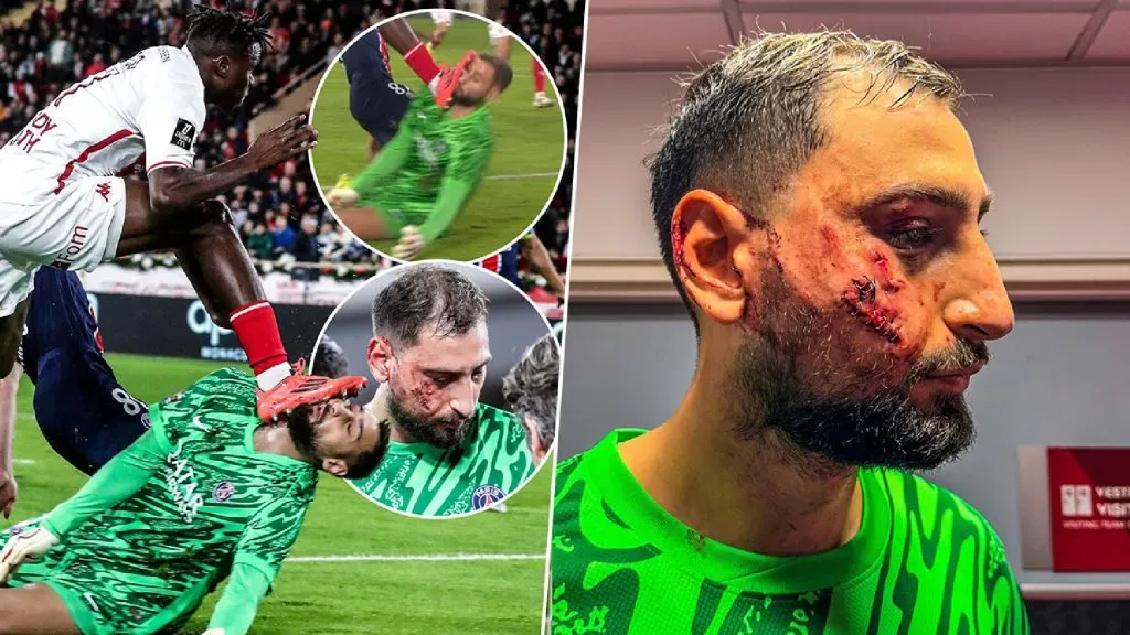 Así quedó el restro de Donnarumma.