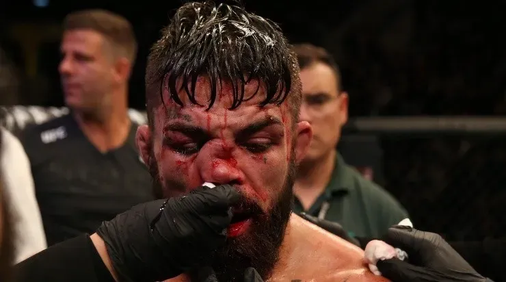 La sorprendente fractura de nariz de Mike Perry (Foto: Getty Images)