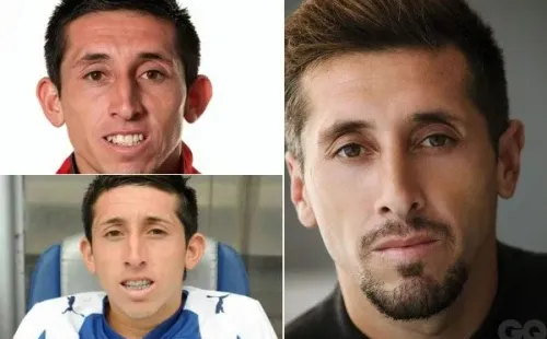 Héctor Herrera, antes y después de sus operaciones. Foto: Diario Diez