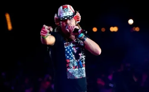 Bret Michaels, vocalista de Poison ha sufrido con la caída de cabello.