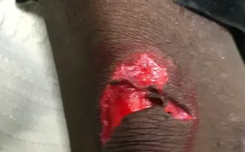 Así terminó el talón de Waterman. Foto: Twitter