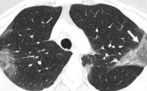 Imagen de Radiological Society of North America.