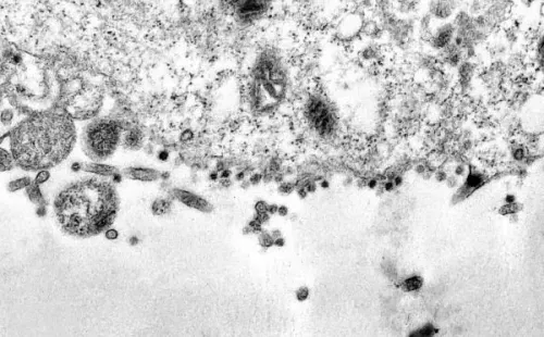 El Covid-19 comienza a acechar a las células (EFE).