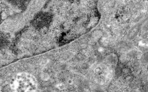 El Covid-19 comienza a infectar a las células (EFE).