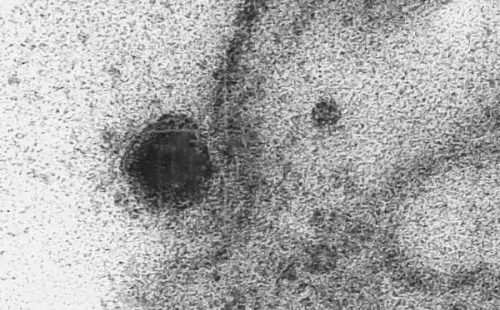 El Covid-19 ya infectó a las células (EFE).