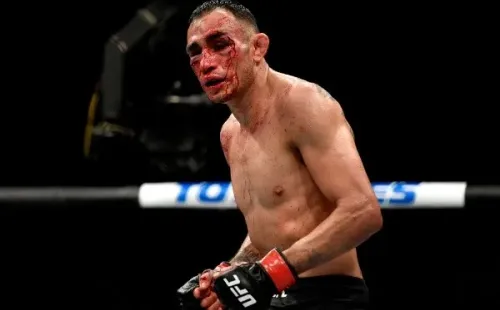 La cara de Tony Ferguson quedó con varias heridas graves tras su derrota en el UFC 249. Foto: Getty Images