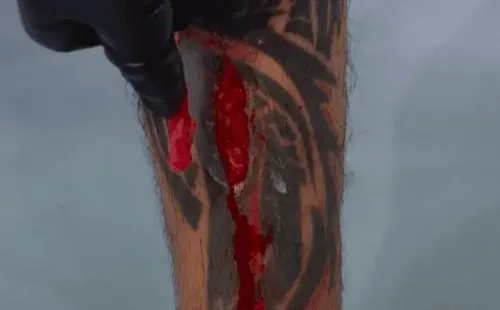 Así fue el terrible corte de Gabriel “Moggly” Benítez tras su combate con Omar Morales en el UFC Jacksonville(o #UFCJax).