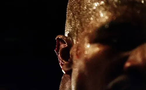 Así terminó la oreja de Evander Holyfieldtras la mordida deMike Tysonen su segudo combate. Foto: Getty Images