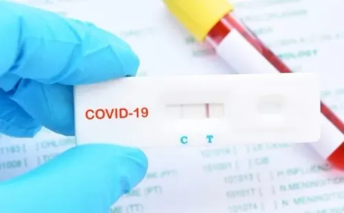 Los test de PCR se habrían limitado.
