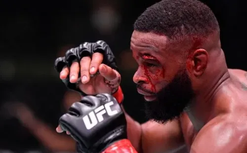 Tyron Woodley terminó con un feo corte en su ceja tras su pelea con Gilbert Burns. Foto: Getty Images