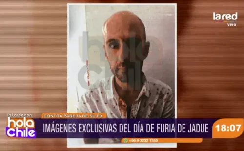 Así quedó Sergio Jadue tras ser golpeado en Miami. (Gentileza de La Red)