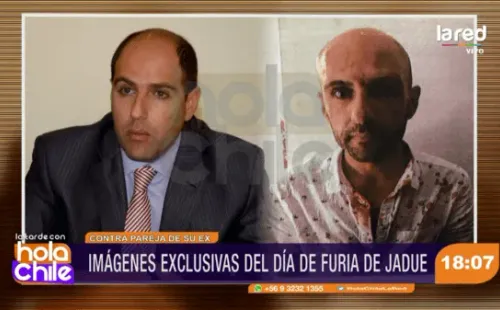 Hola Chile mostró a Jadue golpeado y lleno de sangre tras su pelea.