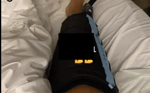 Jorquera se tomó con optimismo la dura lesión que sufrió en Turquía (Instagram)