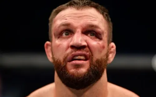 El rostro de Phillips tras recibir una paliza por parte deKhamzat Chimaev. Foto: Getty Images