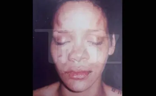 Una de las imágenes que dejó la golpiza de Chris Brown a Rihanna y que TMZ reveló en 2009.