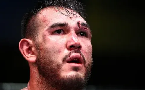 Así terminó el rostro de Augusto Sakai tras la pelea con Overeem. Foto: UFC