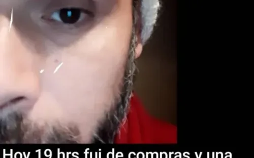Oscar Garcés muestra sus heridas en Instagram.(2)