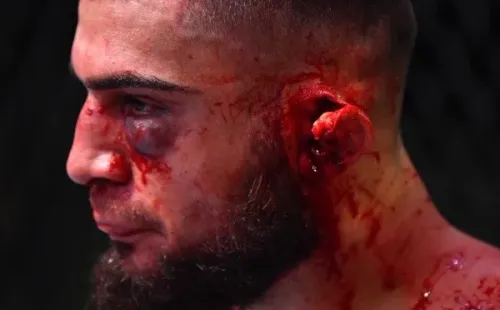 Así quedó la oreja de Ramiz Brahimaj ante Max Griffin en el UFC Vegas 13. Foto: UFC