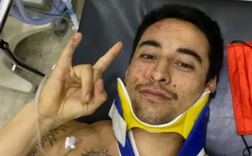 El chileno tuvo un trauma en la cabeza tras chocar en el kilómetro 252 de la décima etapa.