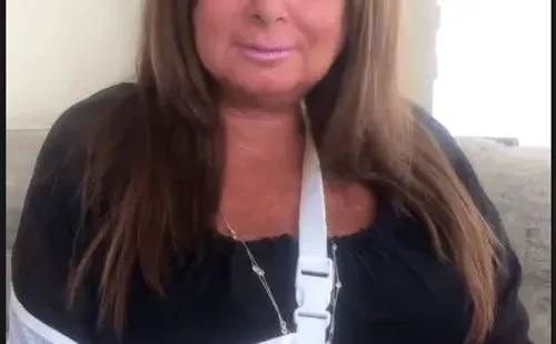 Así se mostró la Tía Sonia en sus historias de Instagram, tras su caída en Maitencillo.