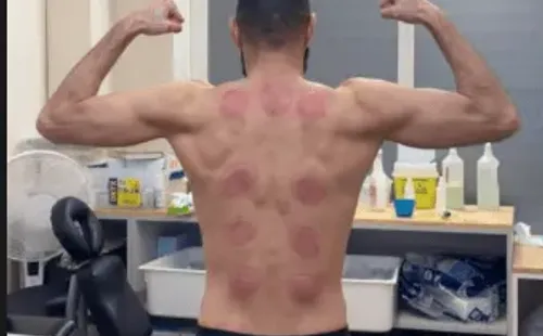 El resultado del tratamiento de Karim Benzema