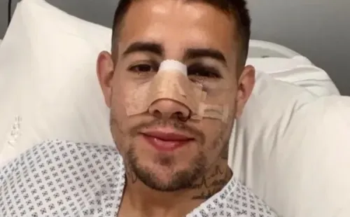 Rodrigo Holgado se operó el miércoles pasado de la fractura nasal sufrida ante Melipilla. Foto: Audax Italiano.