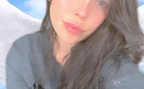 Las historias con que Daniela Aránguiz mostró su nueva boca.(1)