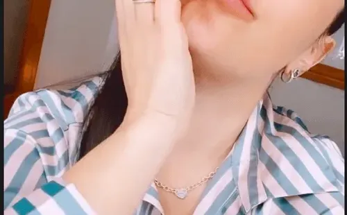 Las historias con que Daniela Aránguiz mostró su nueva boca.(2)