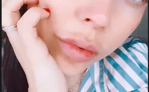 Las historias con que Daniela Aránguiz mostró su nueva boca.(3)
