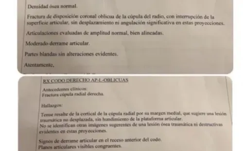 Las historias de Nano Calderon relatando su accidente, por salvar a la perrita que escapó de su dueña.(5)